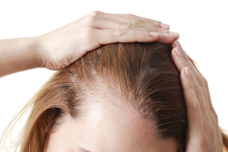 Một số bệnh lý của tuổi dậy thì có thể gây rụng tóc 