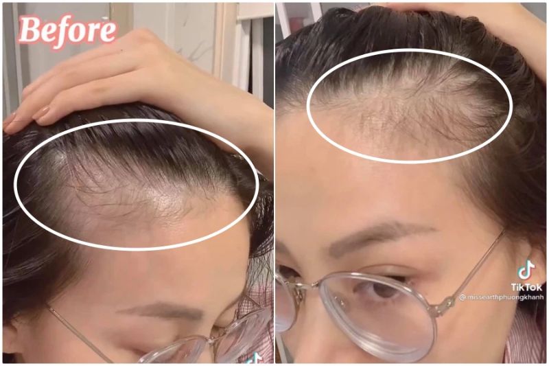 Hoa hậu Phương Khánh ủ tóc với nước vo gạo để trị tóc rụng tại nhà