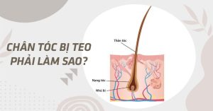 Cách khắc phục chân tóc bị teo