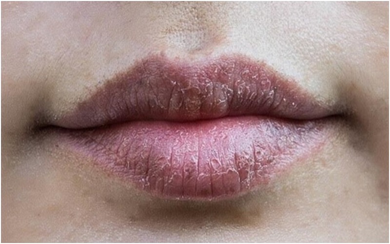 Dấu hiệu nhận biết phun môi bị hỏng