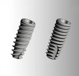 Trụ Implant Tekka Pháp Là Gì? Ưu Điểm Và Chi Phí 1 implant tekka phap 2
